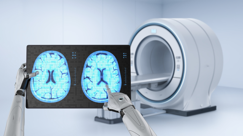 AI adoption is the main trend in the medical image analysis software development market.