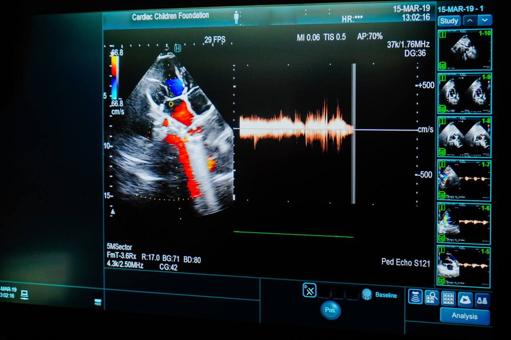 Image segmentation is one of the key medical image analysis software features.