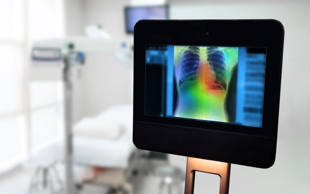 Image analysis is one of the most successful machine learning use cases in healthcare.